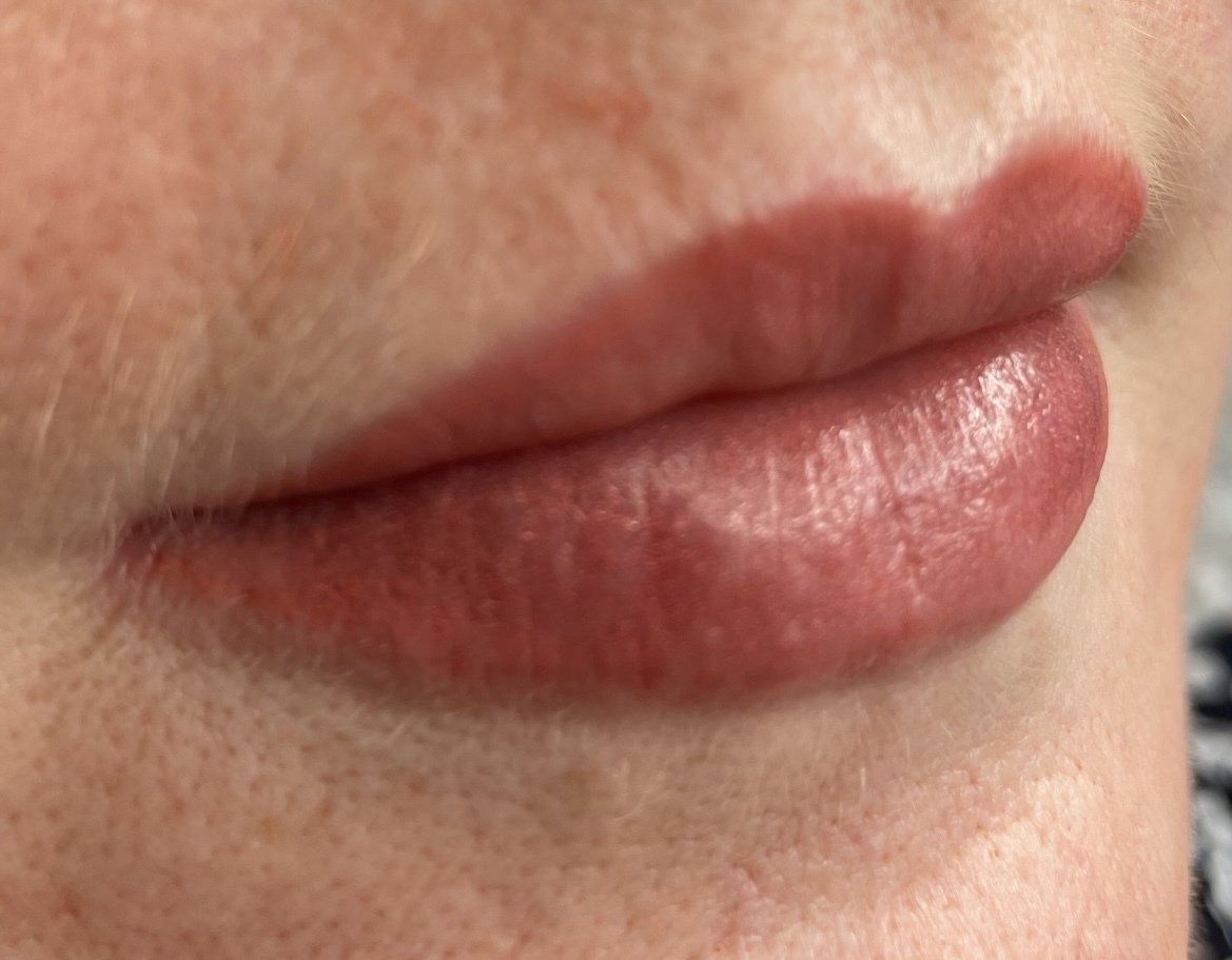 lips waterloo