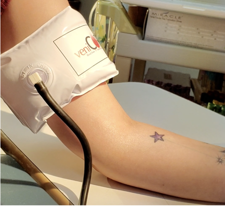 Medical professional drawing blood from a forearm with a syringe and tube in a clinical setting.