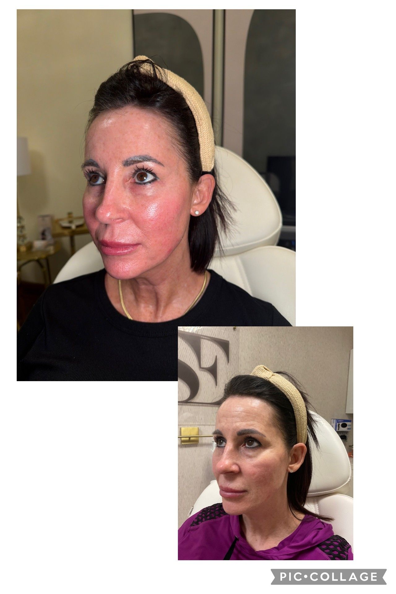 Side-by-side portrait photos of a woman in a black top, wearing a headband, with a neutral expression.