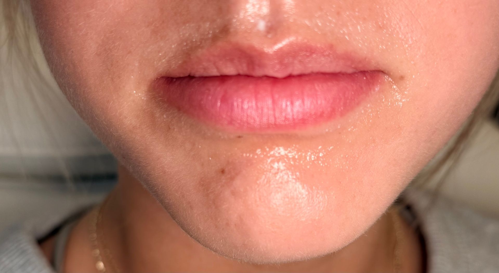 Close-up of glossy pink lips and lower face with a neutral expression
