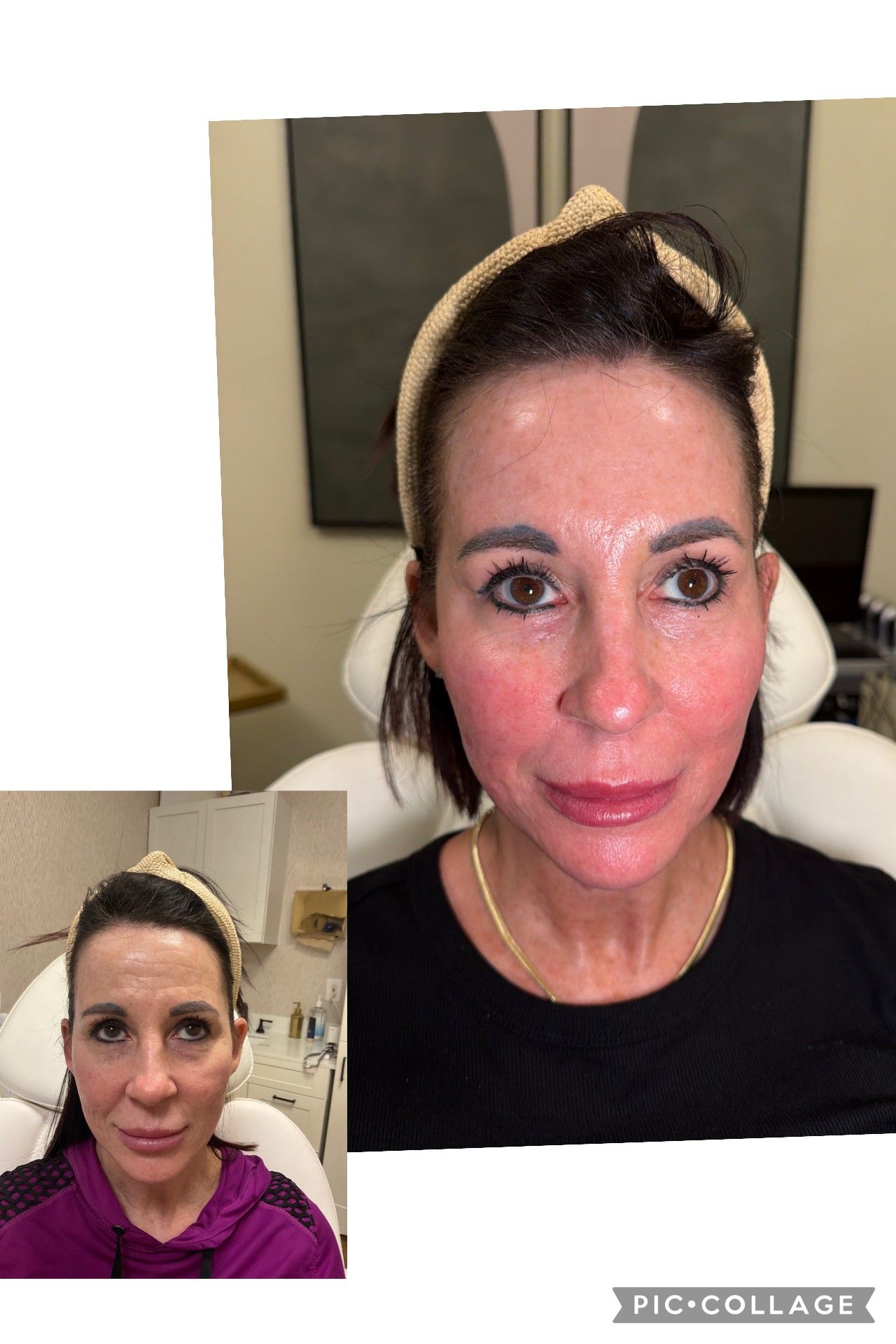 Two selfies of the same person, one close-up and one smaller inset, both indoors with a neutral background