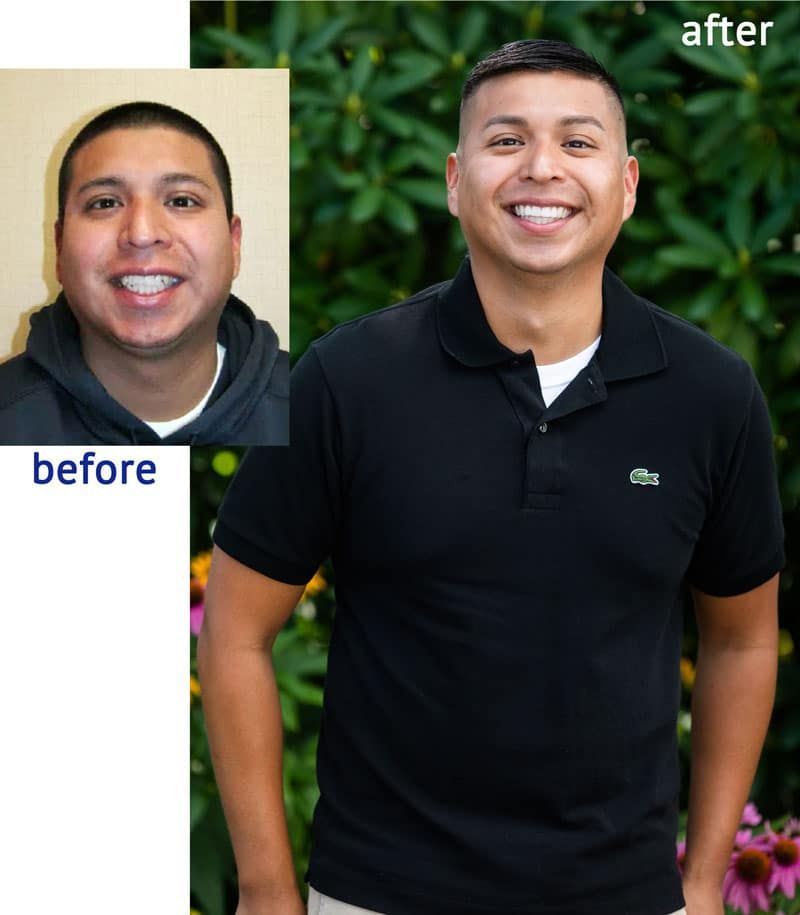 Man's teeth before and after cosmetic dental work. He smiles broadly in the 'after' photo, wearing a black polo shirt.