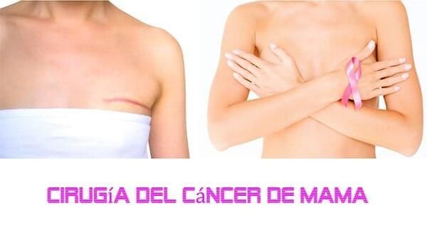 CLÍNICA DE PATOLOGÍA MAMARIA