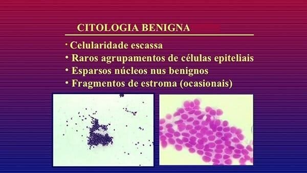 CLÍNICA DE PATOLOGÍA MAMARIA