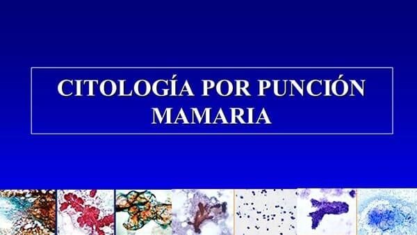 CLÍNICA DE PATOLOGÍA MAMARIA