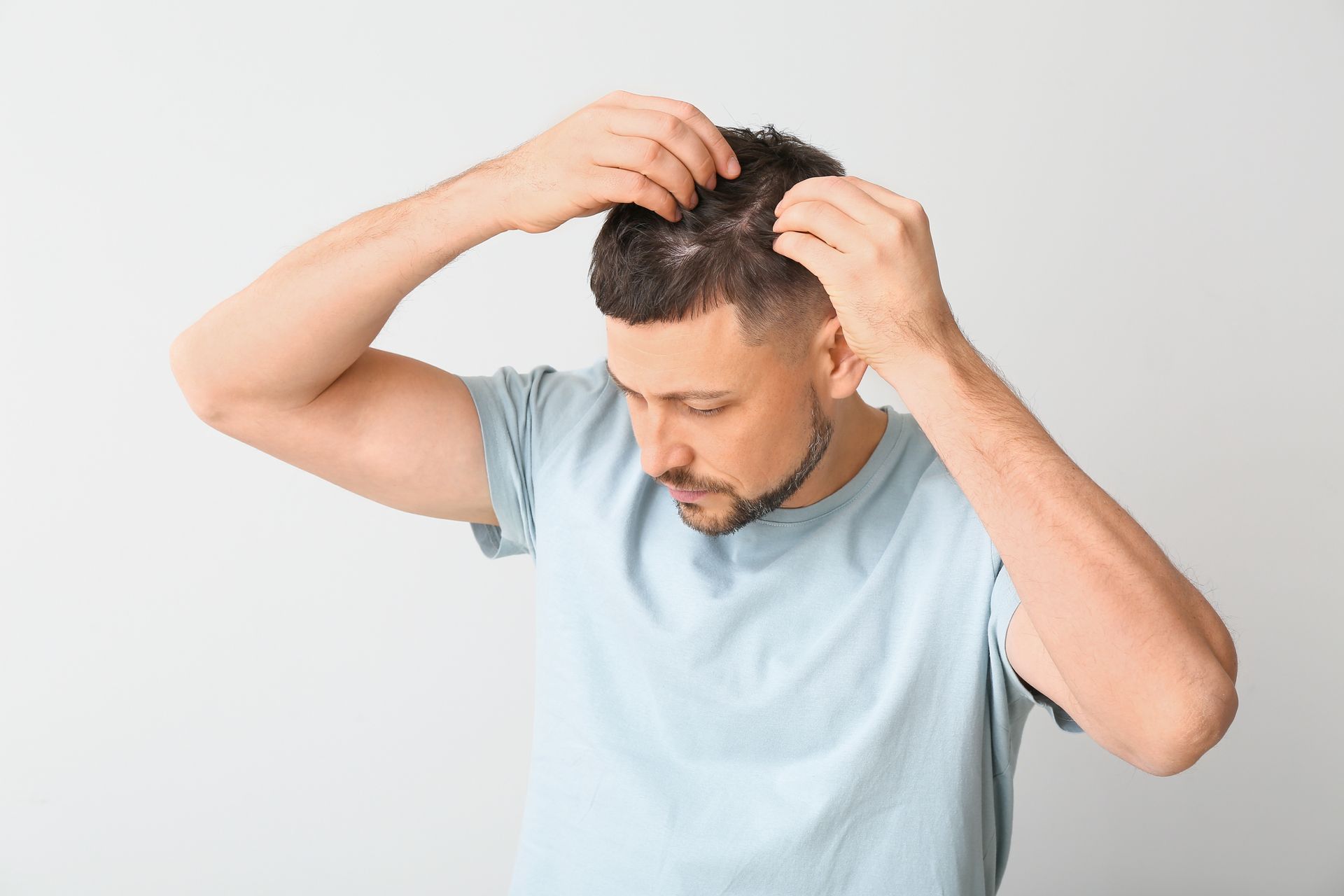 Man checking thinning scalp before booking an appointment at a local hair loss treatment clinic. Man checking thinning scalp before booking an appointment at a local hair loss treatment clinic.