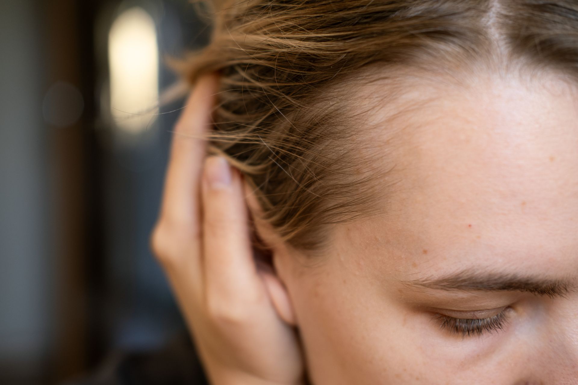 Close-up of a person's receding hairline and thinning hair near her temple. Close-up of a person's receding hairline and thinning hair near her temple.