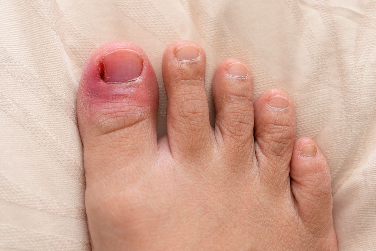A close up of a person 's foot with a red toenail.