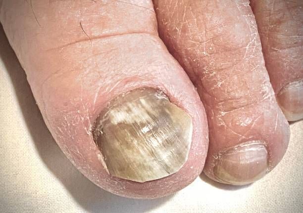 A person is scratching their ankle with their hand.