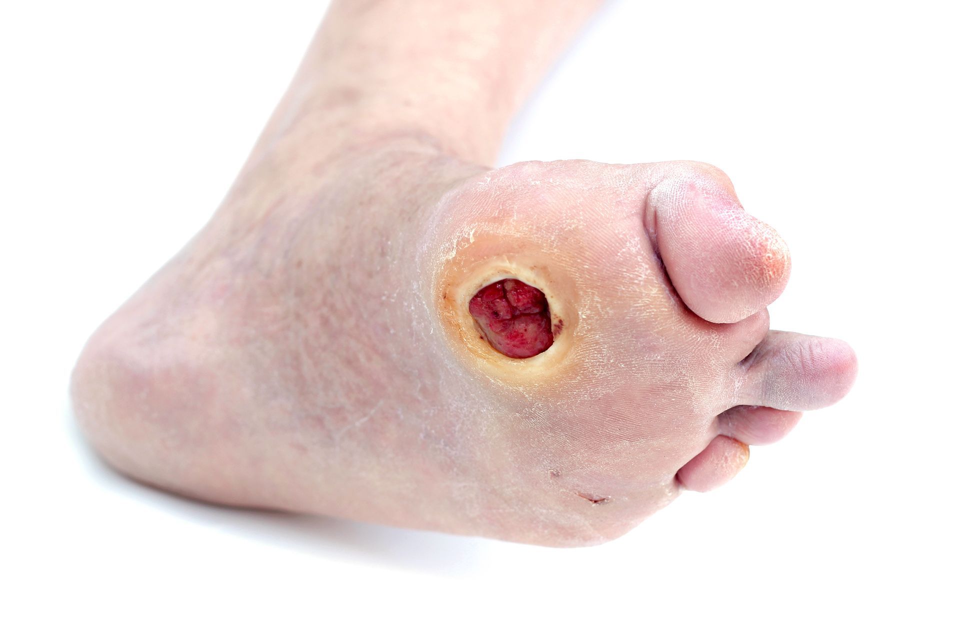 A person is walking barefoot on a wooden floor.