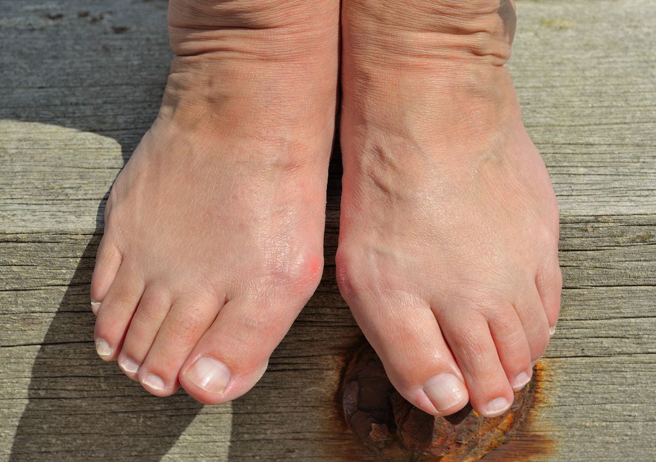 A close up of a person 's feet sitting on a wooden dock.