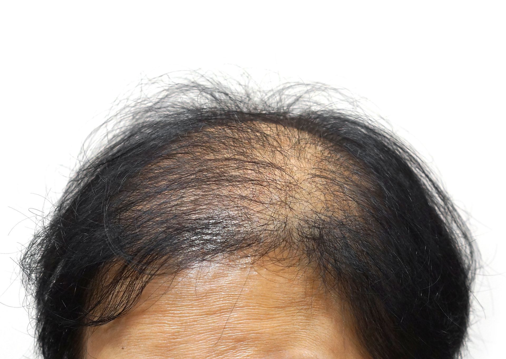 A close up of a person scratching their head