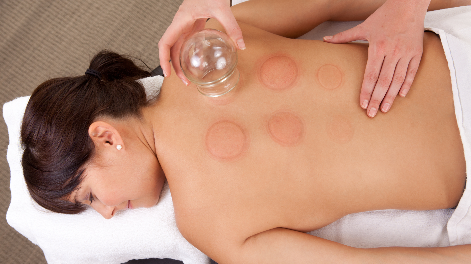 cupping