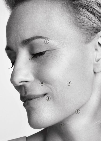 Microneedling Behandlung zur Hauterneuerung