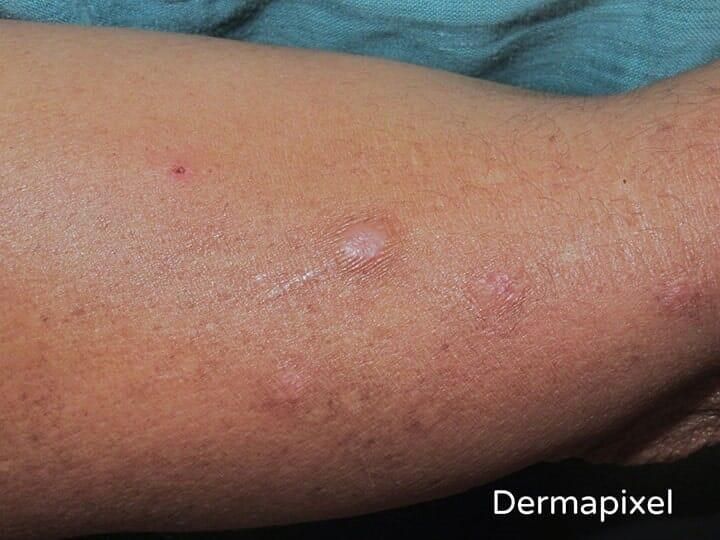 Dra. Mary Ann Weaver Velasco