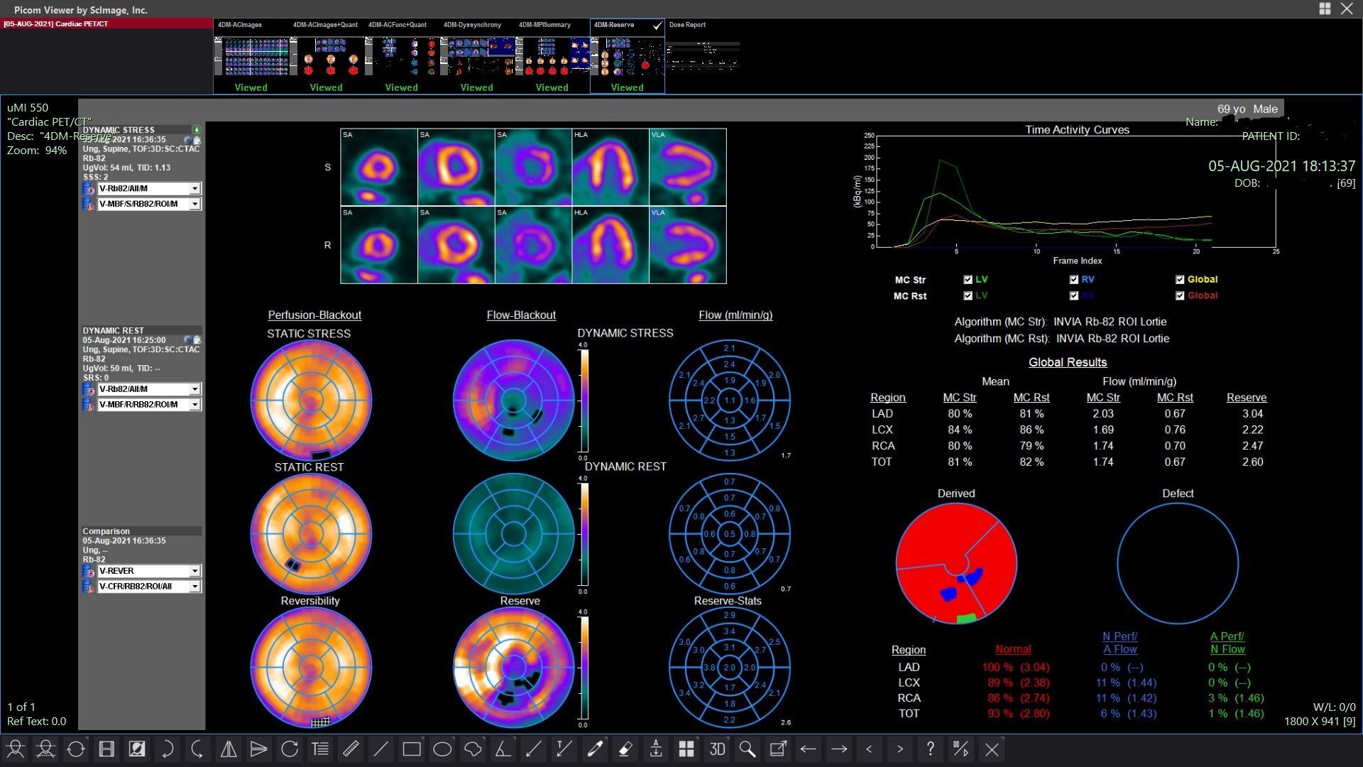 echocardiogram+san+luis+obispo+ca