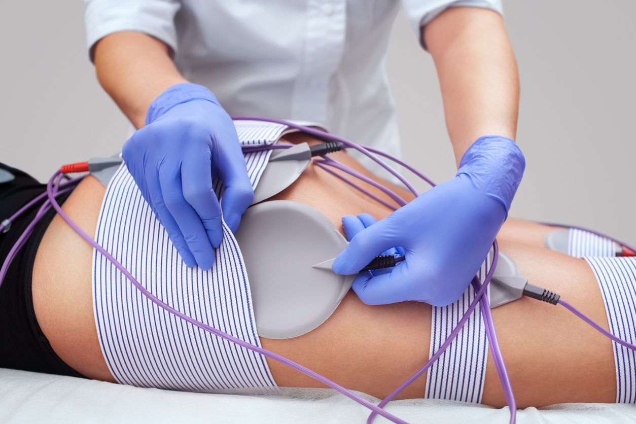 Una persona recibe terapia de estimulación muscular eléctrica, mientras un técnico ajusta los electrodos colocados en su muslo.