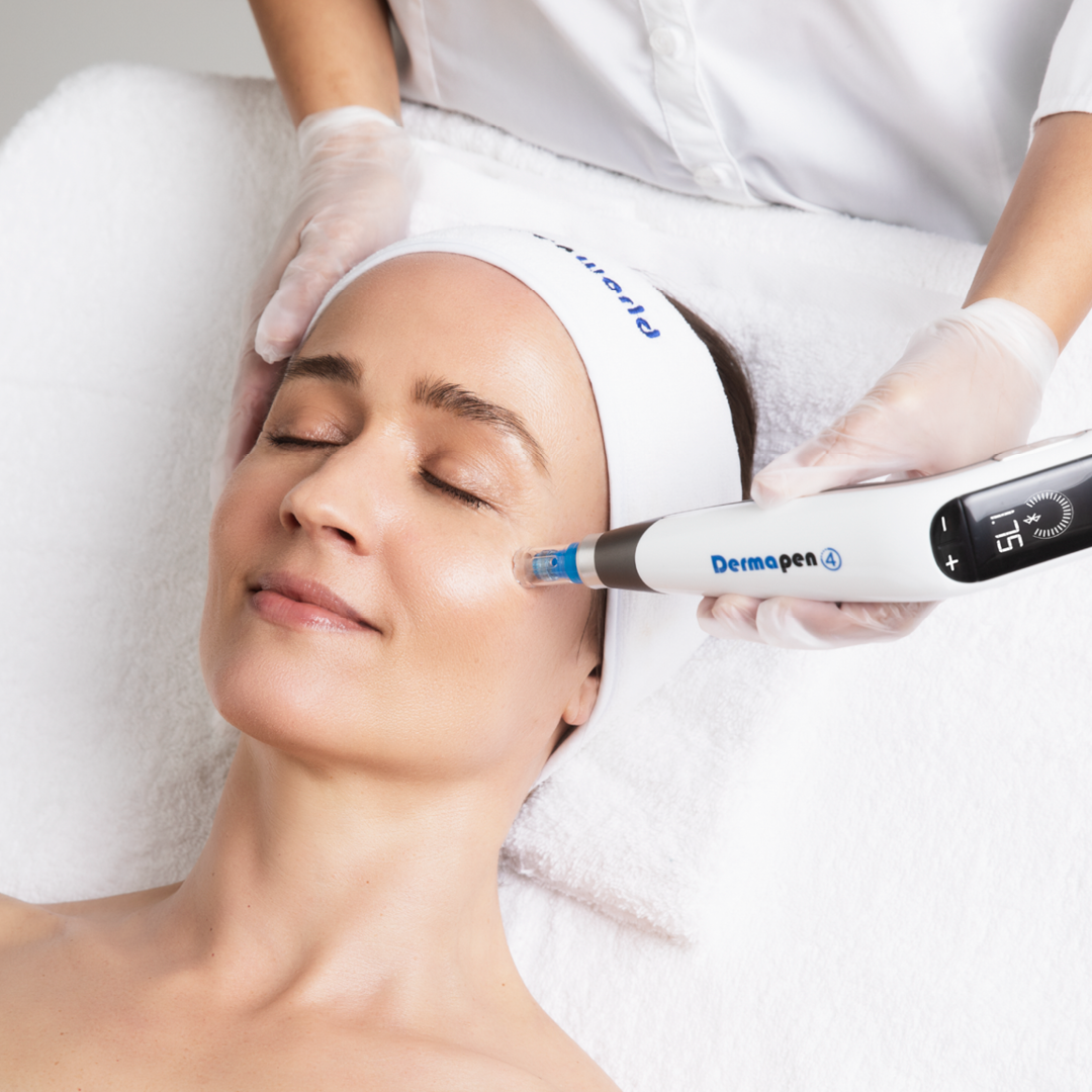 Eine Frau bekommt eine Derma-Pen-Behandlung im Gesicht