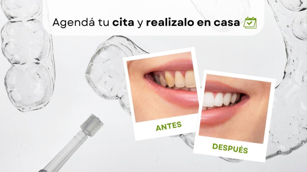 Una fotografía de antes y después de los dientes de una mujer.