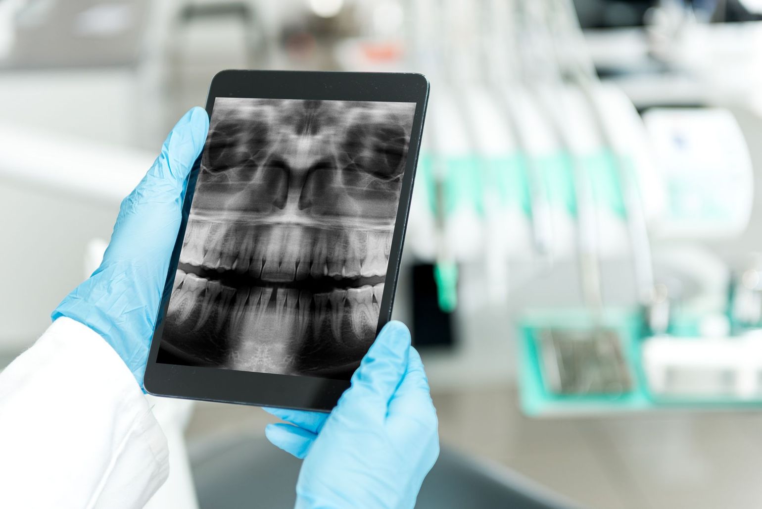 Un dentista sostiene una tableta con una radiografía de los dientes de una persona.