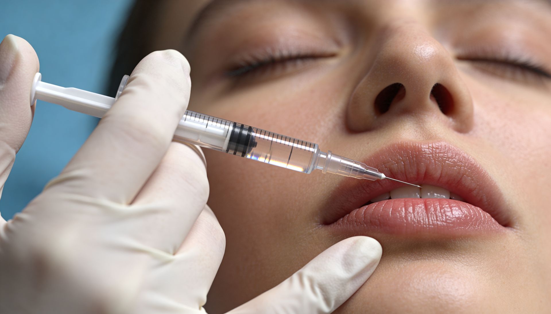 Gloved provider giving a lip filler injection to a woman's lips with a fine syringe