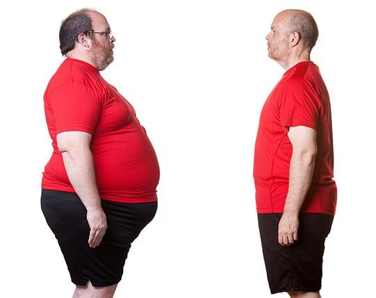 Man Having Weight Loss — Ridgewood. NJ — The Institute for Medical Weight Loss and Nutrition weight loss Ridgewood, NJ
