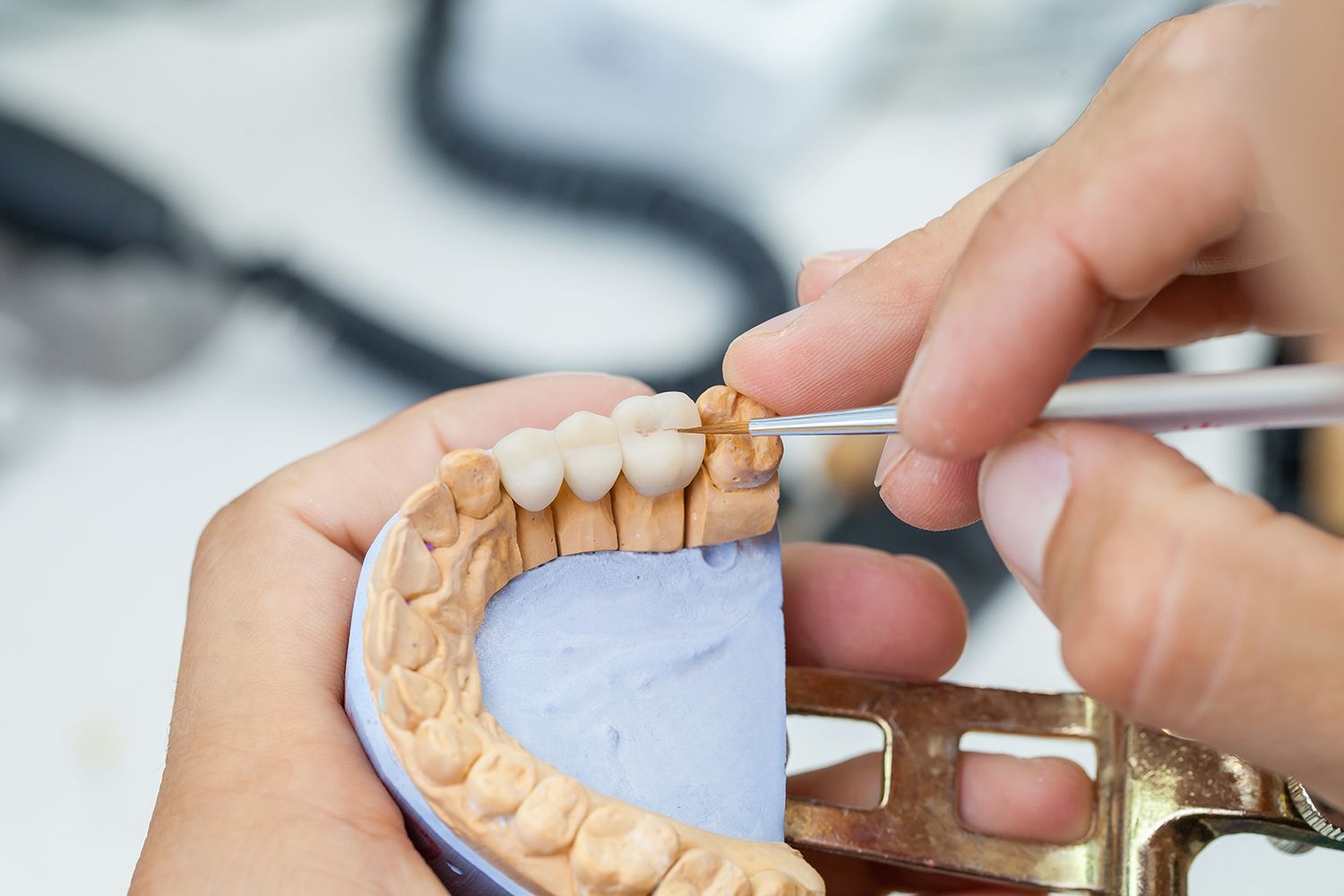 A dentist is working on a model of a person 's teeth.