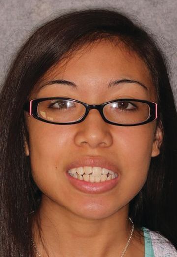 A close up of a woman wearing glasses and smiling