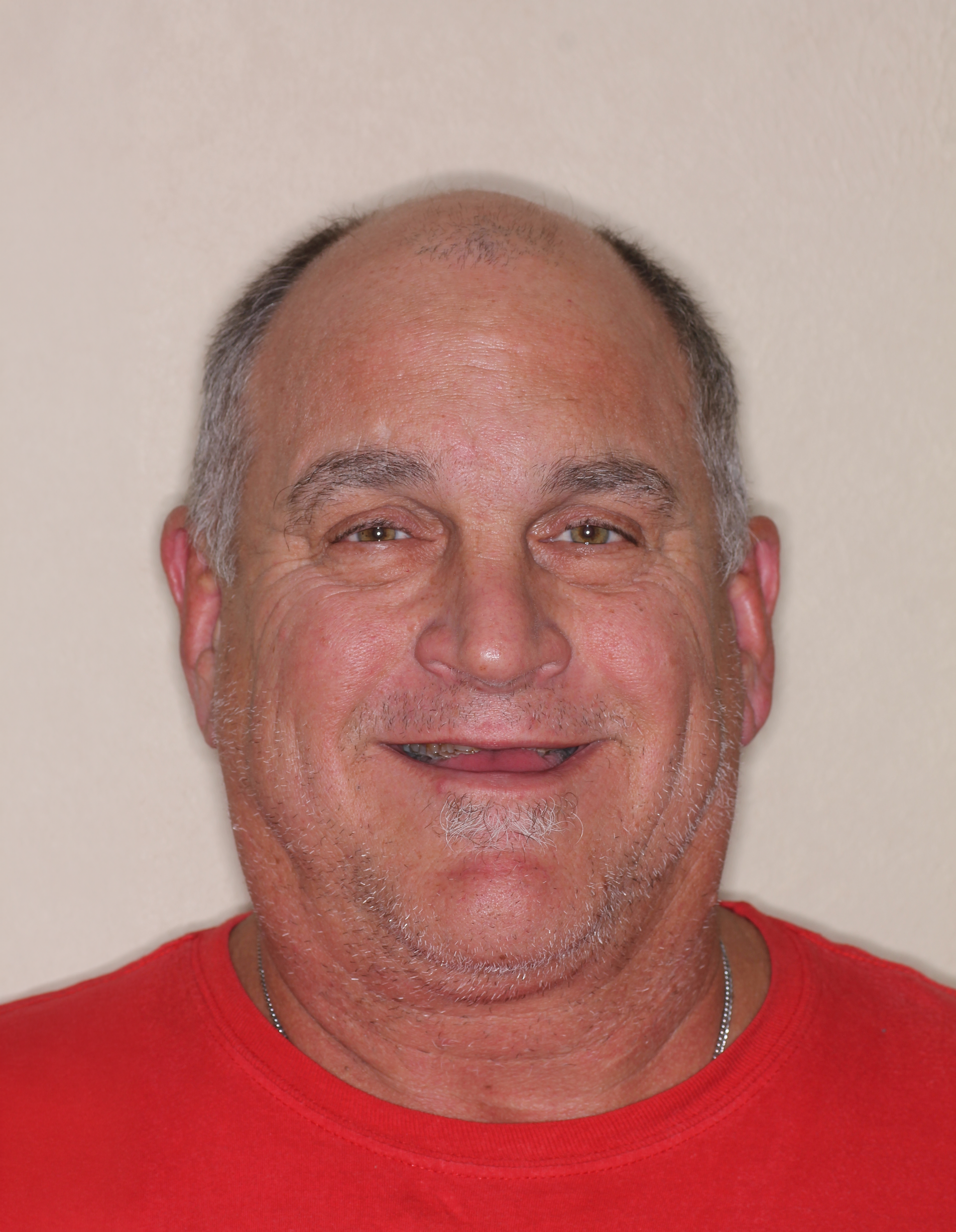 A close up of a smiling man before dental implants at Dental Arts KC
