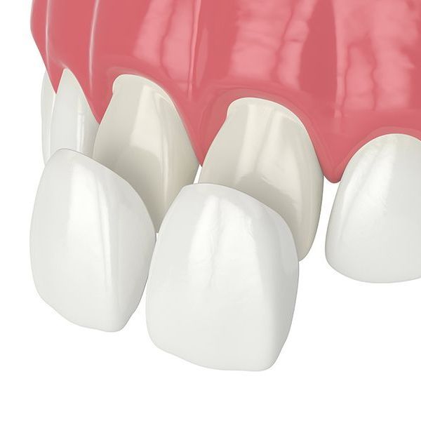 A close up of a pair of teeth with a pink gums.