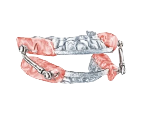 Respire Pink EF Sleep Apnea Treatment