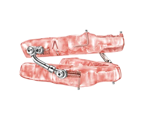 Respire Pink
 Micro Sleep Apnea Treatment
