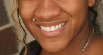 Close up of a woman's smile after cosmetic dental procedures