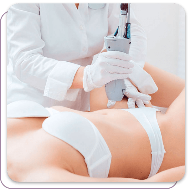 Eine Frau bekommt eine Laserbehandlung am Bauch.