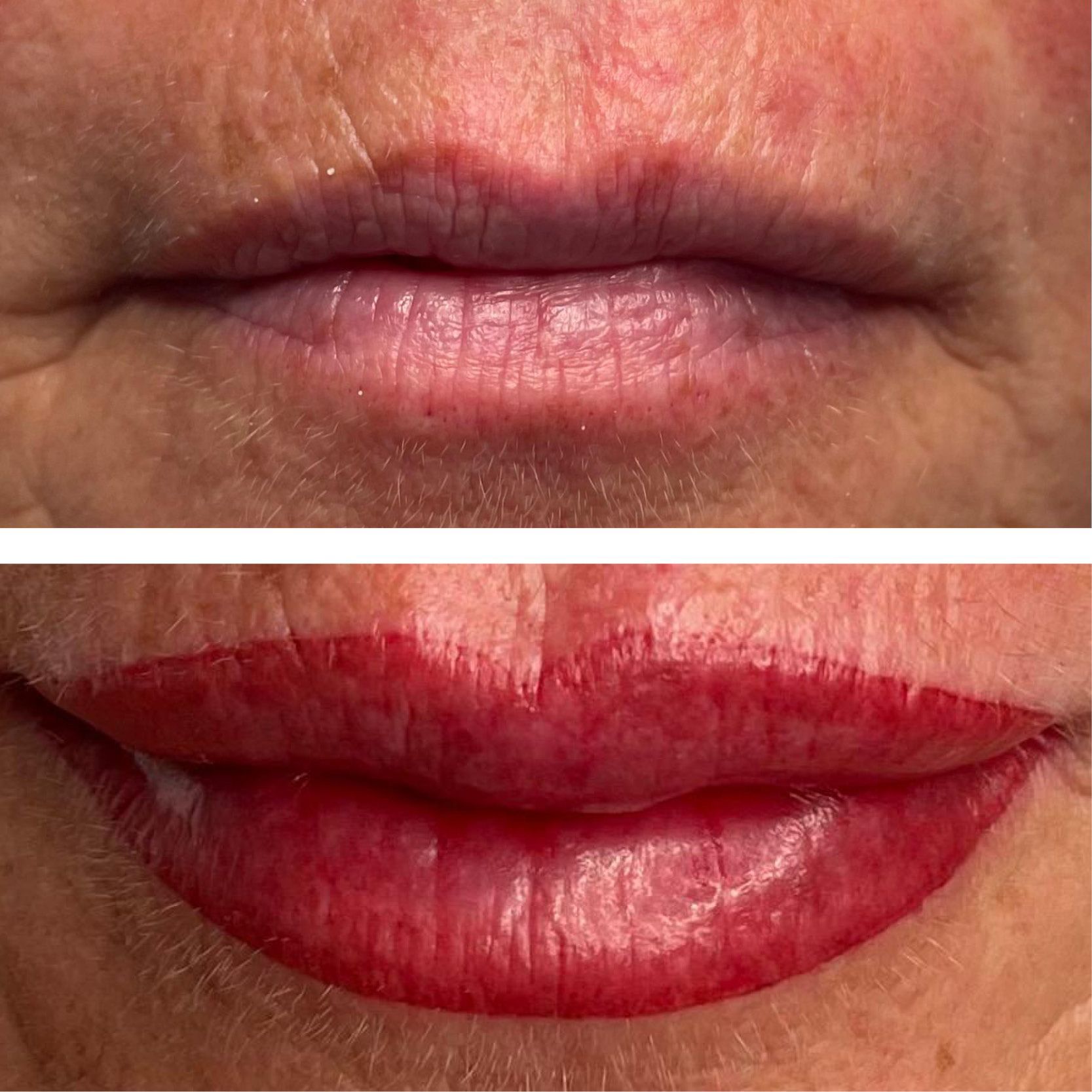 Vorher nachher Vergleich von Lippen
