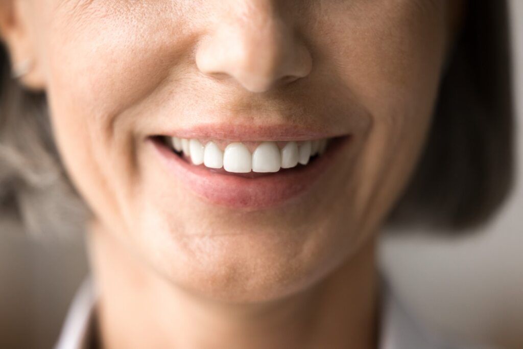 Close-up of a Woman Smiling, Showing White Teeth — Smiles on Hudson In Hamilton, NSW