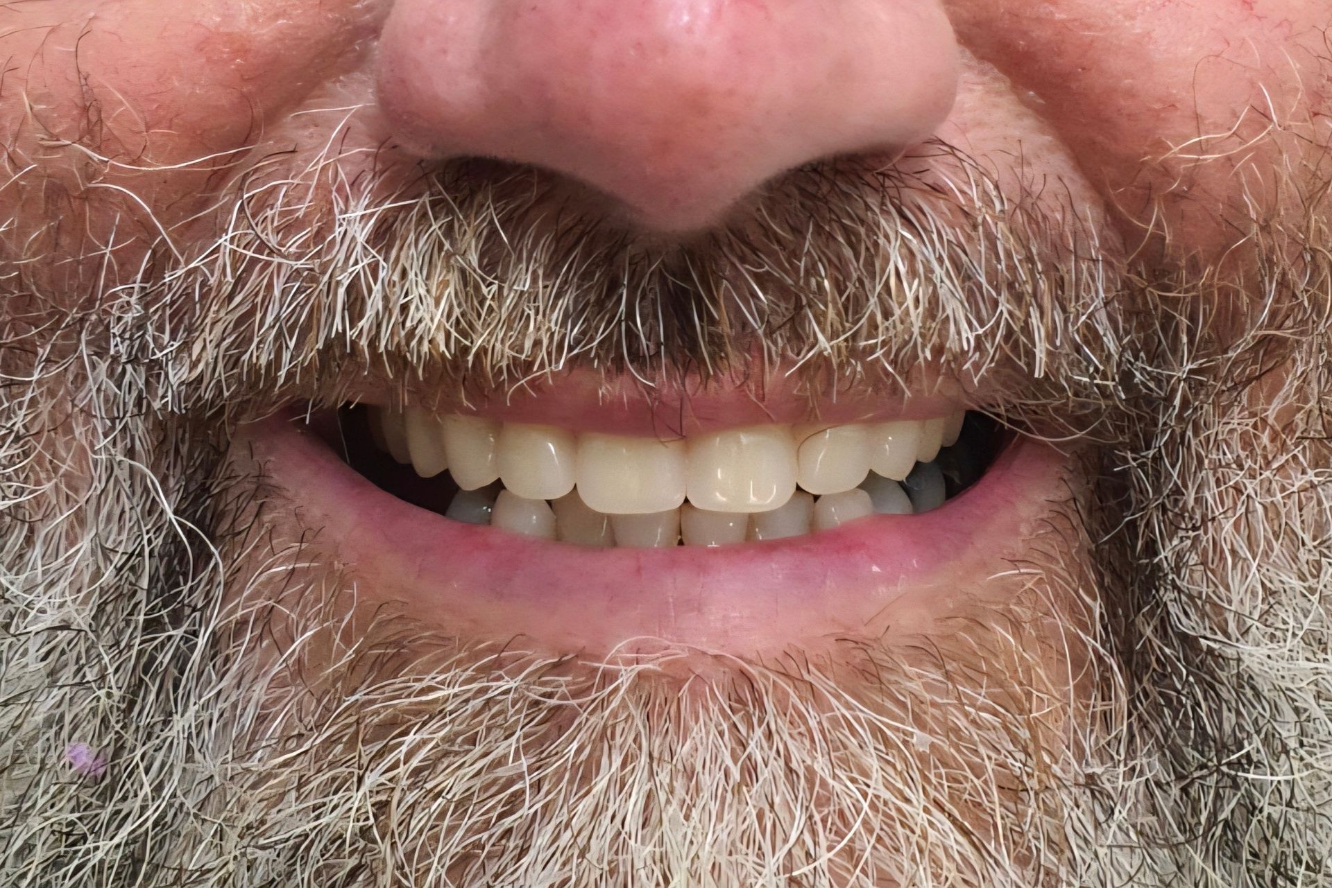 Smiling Older Woman With New, Bright White Teeth — Smiles on Hudson In Hamilton, NSW
