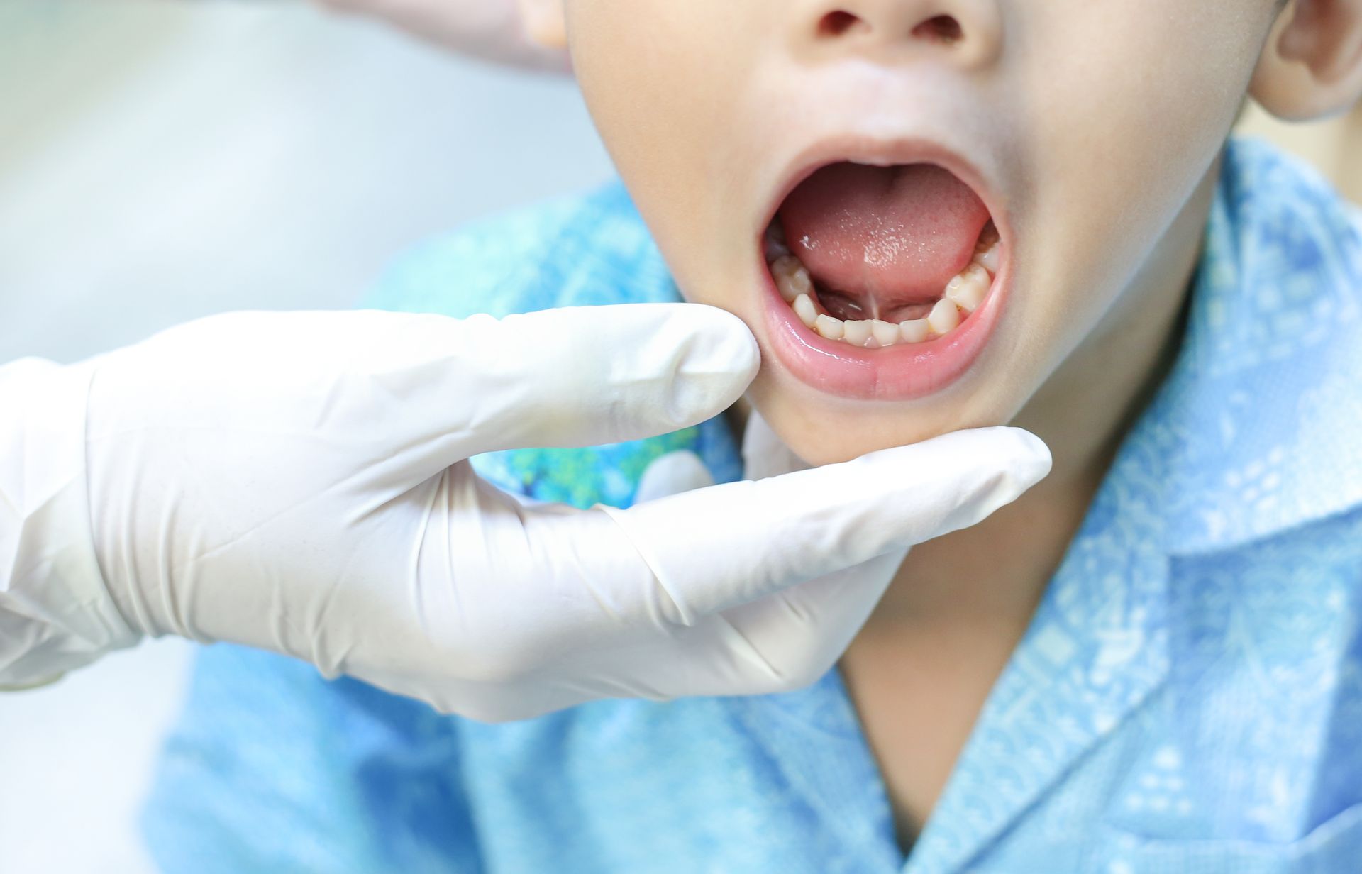 Child with mouth open being examined by gloved hand.