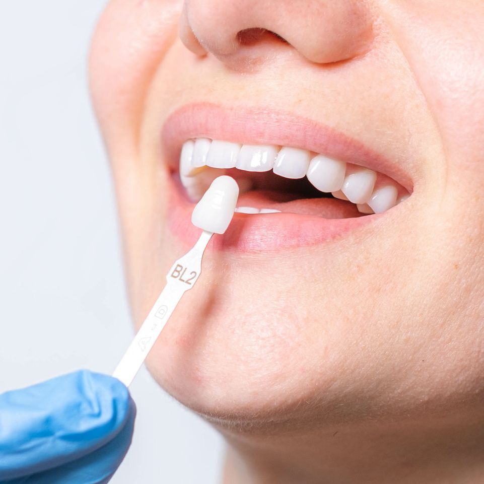 A close up of a person's teeth with a black background