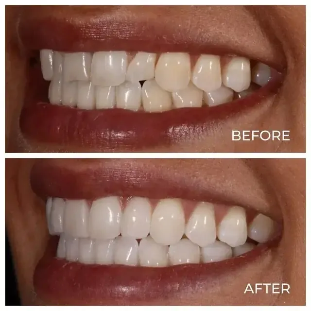Before image 3