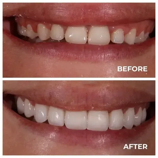 Before image 1