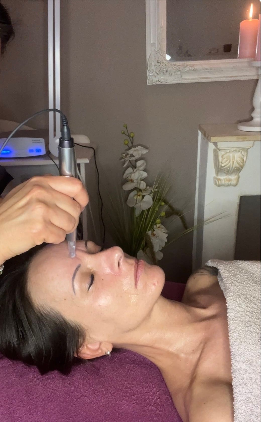 Microneedling