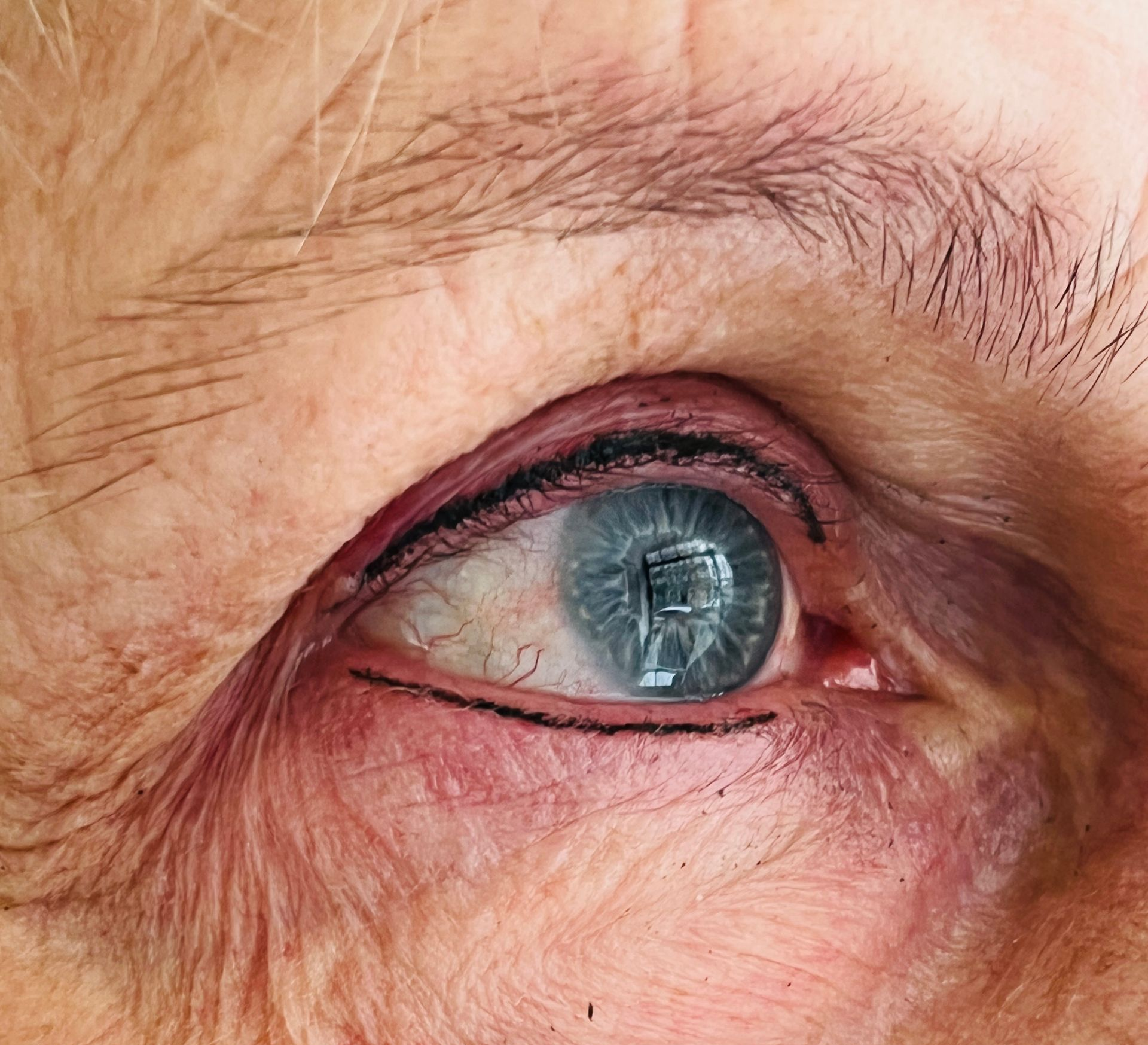 Wimpernkranz
