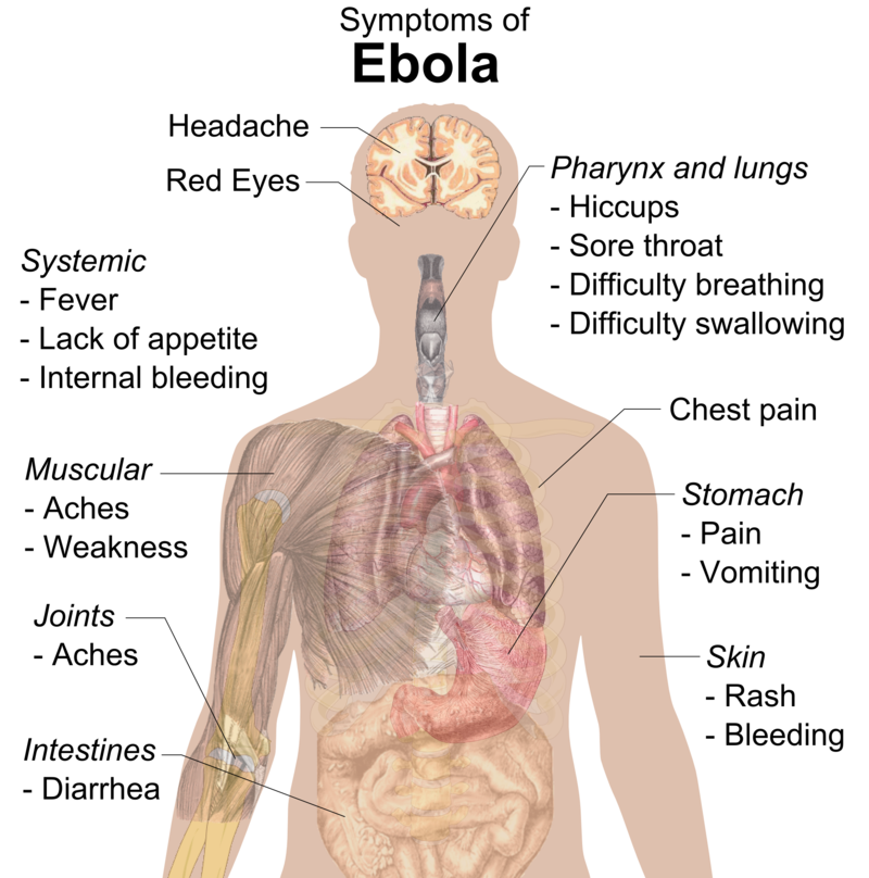 Ebola investigation Symptoms Www.Nowpi.com Ebola investigation Symptoms