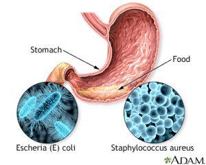 food poisoning