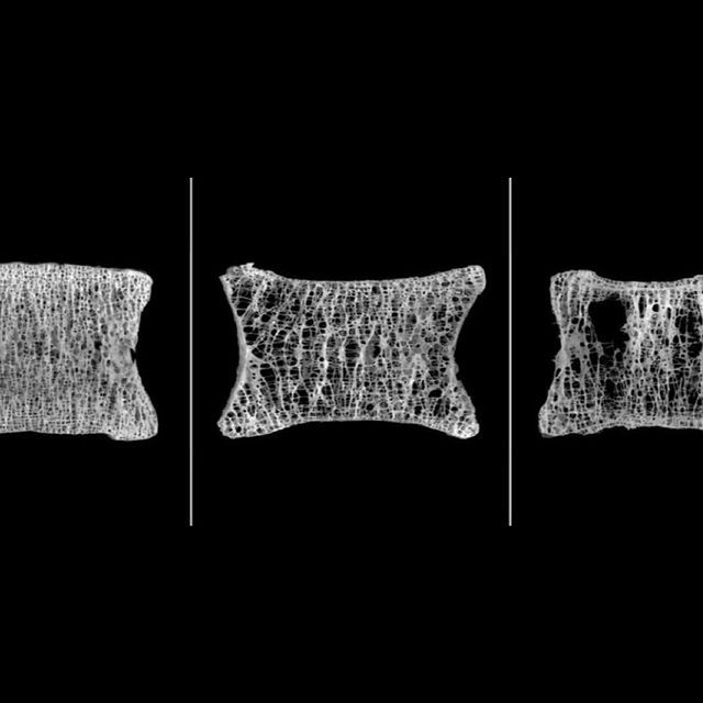 X ray of bone structure