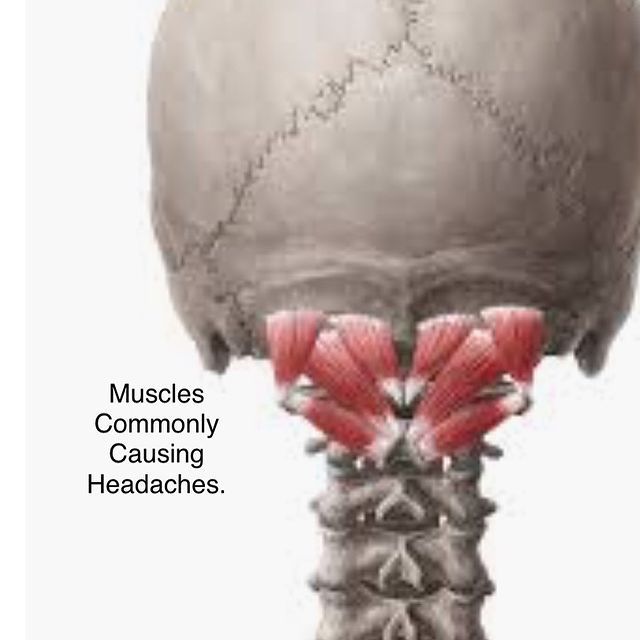 Spine and skull diagram