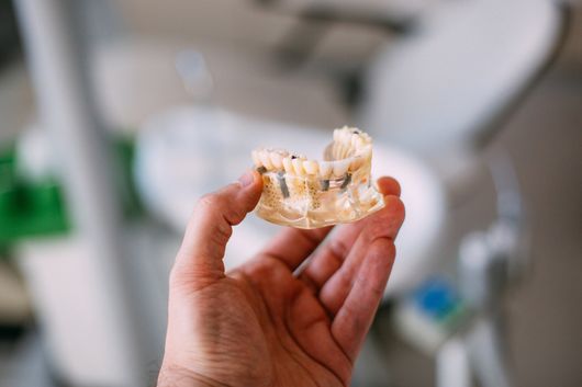 Implantologia dentale