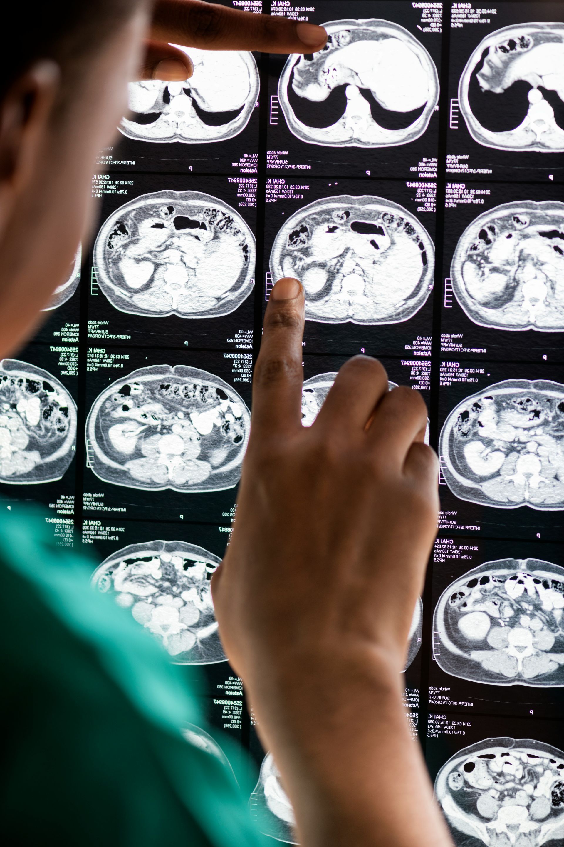 A person in a teal uniform examines abdominal CT scan images, pointing at one.