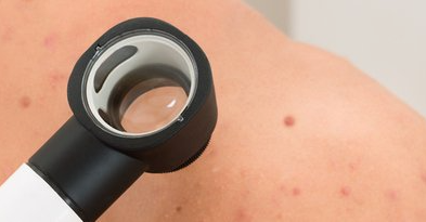 closeup of infected fingernail